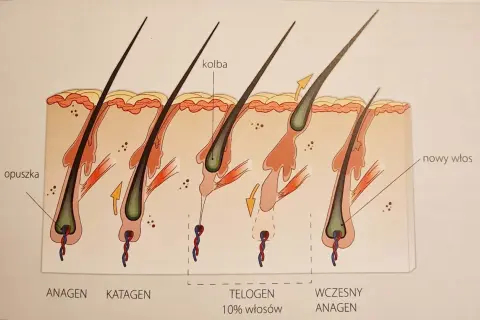 Cykl życia włosa: anagen, katagen, telogen (10% włosów wypada dziennie), wczesny anagen z nowym włosem.